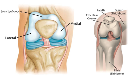 Patellofemoral joint replacement